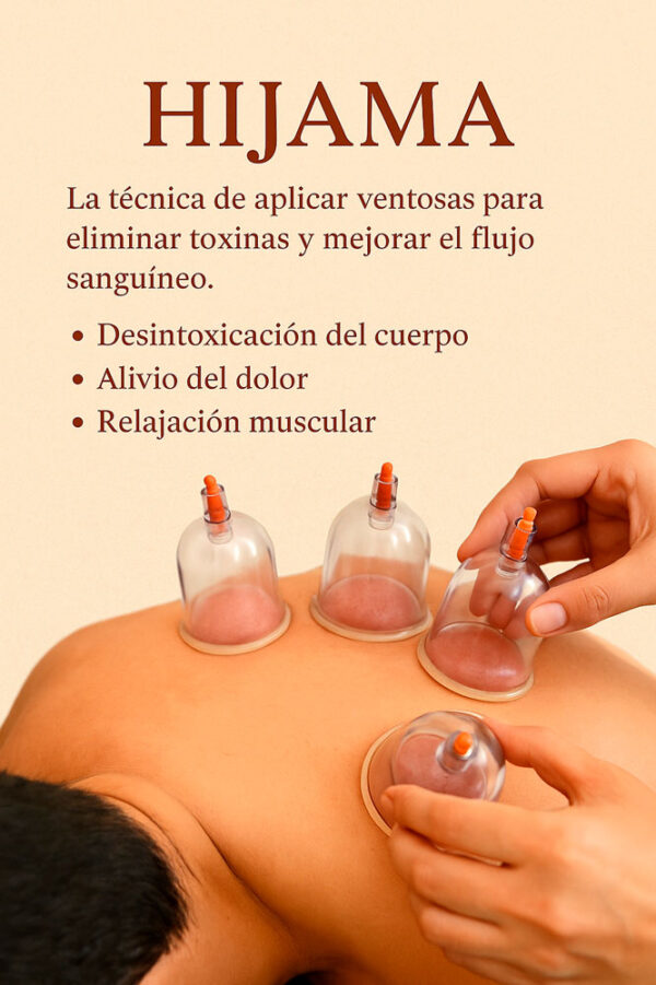 Tratamiento Hijama
